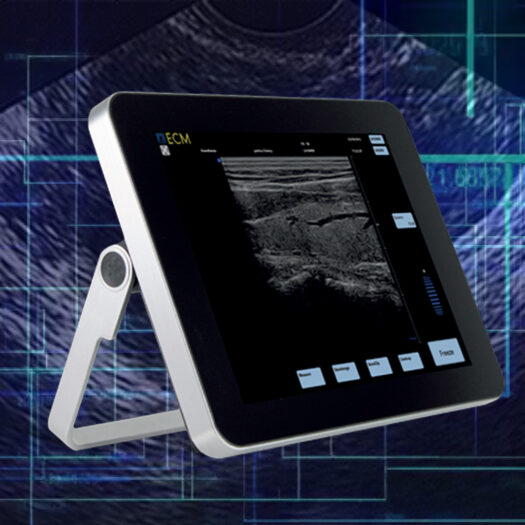 Echographie – Echoscopie