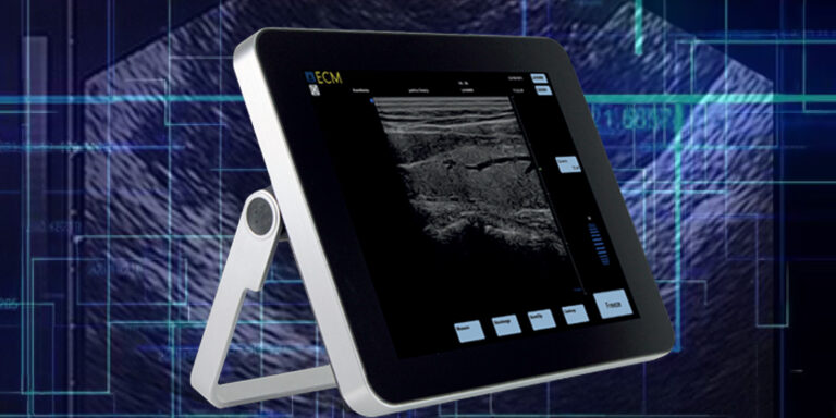 Echographie–Echoscopie Echographie – Echoscopie