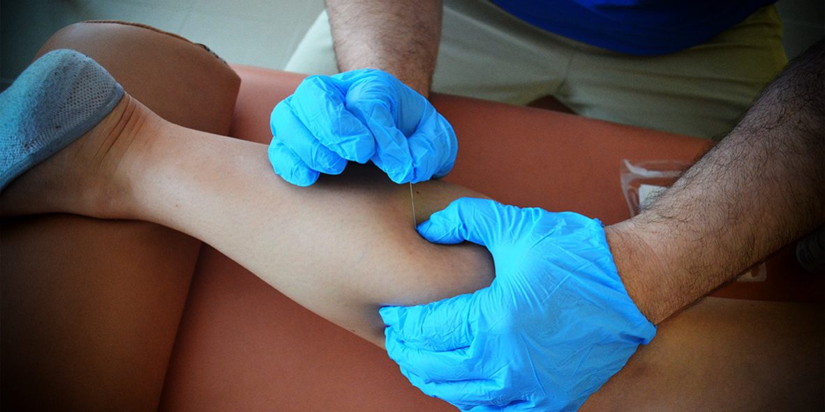 Formation en Dry-Needling Formation en Dry-Needling