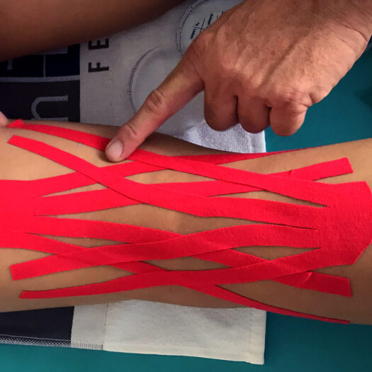 Formation en Physio-tape