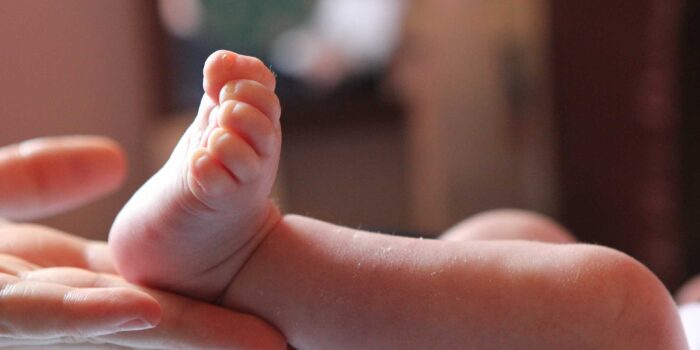 Rééducation du pied du nourrisson : De la simple malposition au Pied Bot Varus Equin